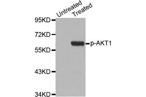 Western Blotting (WB) image for anti-V-Akt Murine Thymoma Viral Oncogene Homolog 1 (AKT1) (pSer473) antibody (ABIN1513328) (AKT1 anticorps  (pSer473))