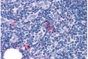 Anti-GPR97 antibody  ABIN1048901 IHC staining of human thymus, medulla. (GPR97 anticorps  (Extracellular Domain))