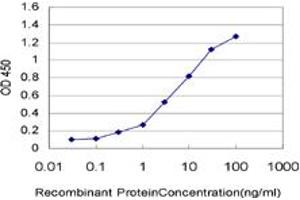 Detection limit for recombinant GST tagged SURB7 is approximately 0. (MED21 anticorps  (AA 1-144))