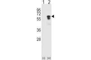 Western Blotting (WB) image for anti-Activin Receptor Type I (ACRV1) antibody (ABIN3003503) (ACVR1 anticorps)