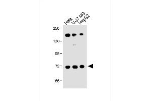 All lanes : Anti-FBXL5 Antibody (N-term) at 1:1000 dilution Lane 1: Hela whole cell lysate Lane 2: U-87 MG whole cell lysate Lane 3: HepG2 whole cell lysate Lysates/proteins at 20 μg per lane. (FBXL5 anticorps  (N-Term))