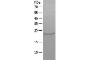 Western Blotting (WB) image for Cytidine Monophosphate (UMP-CMP) Kinase 1, Cytosolic (CMPK1) (AA 1-228) protein (His-IF2DI Tag) (ABIN7124226)