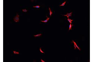anti-Parkinson Protein 7 (PARK7) (C-Term) antibody