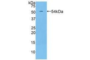 Western blot analysis of recombinant Rat PZP. (PZP anticorps  (AA 1251-1500))