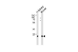 Western blot analysis of lysates from human kidney and liver tissue lysate (from left to right), using CLDN14 Antibody (C-term) (ABIN1881208 and ABIN2838931). (CLDN14 anticorps  (C-Term))