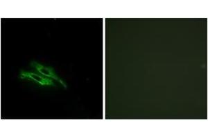 Immunofluorescence analysis of NIH-3T3 cells, using THRB Antibody. (THRB anticorps  (AA 391-440))