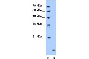 WB Suggested Anti-CRYAB Antibody Titration:  5. (CRYAB anticorps  (C-Term))