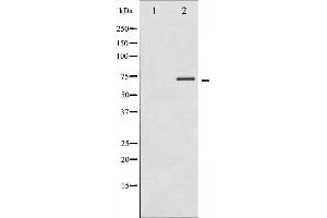 Western blot analysis of p70 S6 Kinase phosphorylation expression in Insulin treated Jurkat whole cell lysates,The lane on the left is treated with the antigen-specific peptide. (RPS6KB1 anticorps  (pThr389, pThr412))
