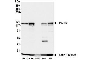 Western Blotting (WB) image for anti-Partner and Localizer of BRCA2 (PALB2) (AA 350-400) antibody (ABIN7795767)
