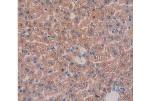 IHC-P analysis of liver tissue, with DAB staining. (Integrin beta 3 anticorps  (AA 135-377))