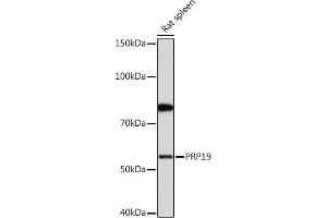 Western blot analysis of extracts of Rat spleen, using PRP19 Rabbit mAb (ABIN7269505) at 1:1000 dilution. (PRP19 anticorps)