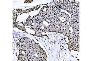 IHC analysis of Nac1/NACC1 using anti-Nac1/NACC1 antibody (ABIN7599756).
