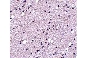 Immunohistochemistry (IHC) image for anti-Tachykinin Receptor 3 (TACR3) (Middle Region) antibody (ABIN1031019) (TACR3 anticorps  (Middle Region))