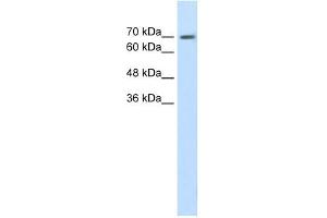 EPS8L1 antibody used at 1. (EPS8-Like 1 anticorps  (N-Term))