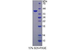SDS-PAGE (SDS) image for Chemokine (C-X-C Motif) Ligand 3 (CXCL3) (AA 33-101) protein (His tag,GST tag) (ABIN6237738)