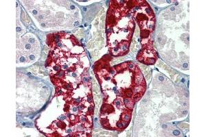 Immunohistochemistry (IHC) image for anti-Glucose 6-Phosphatase, Catalytic (G6PC) (N-Term) antibody (ABIN2781770)