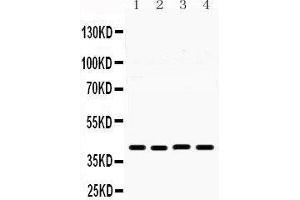 Western Blotting (WB) image for anti-MHC Class I Polypeptide-Related Sequence B (MICB) (AA 23-48), (N-Term) antibody (ABIN3042366) (MICB anticorps  (N-Term))