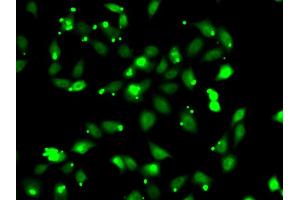 Immunofluorescence analysis of HeLa cells using C1S antibody (ABIN6290127). (C1S anticorps)