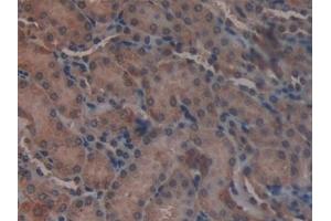 Detection of GLUD1 in Mouse Kidney Tissue using Polyclonal Antibody to Glutamate Dehydrogenase 1 (GLUD1)