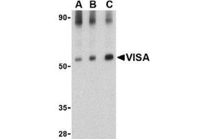 Western blot analysis of VISA in rat brain tissue lysate with this product at (A) 0. (MAVS anticorps  (Middle Region))