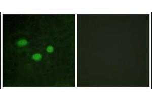 Immunofluorescence analysis of HeLa cells, using DNMT3B Antibody. (DNMT3B anticorps  (N-Term))