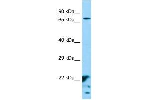 Western Blotting (WB) image for anti-XK, Kell Blood Group Complex Subunit-Related Family, Member 6 (XKR6) (Middle Region) antibody (ABIN2790600) (XKR6 anticorps  (Middle Region))