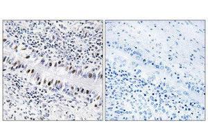 Immunohistochemistry (IHC) image for anti-Zinc Finger Protein 76 (Expressed in Testis) (ZNF76) (Internal Region) antibody (ABIN1849341) (ZNF76 anticorps  (Internal Region))