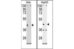 Western blot analysis of anti-hPGK1 pab pre-incubated with and without blocking peptide in Hela (LEFT) and HepG2 (RIGHT) cell line lysate. (PGK1 anticorps  (Middle Region))
