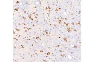 Immunohistochemistry analysis of paraffin-embedded rat brain using,KCNG3 (ABIN7075157) at dilution of 1: 2000 (KCNG3 anticorps)