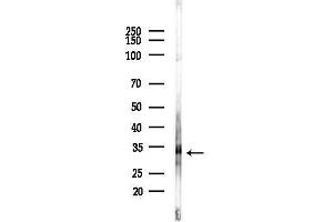 Western blot analysis of lysates from COLO205 cells(heat-shock,45 min treatment), using RN Antibody at 1/1000 dilution.