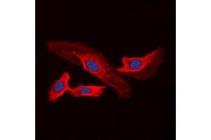 Immunofluorescent analysis of CHSY2 staining in A549 cells.