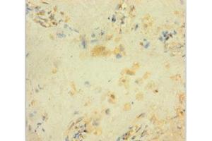 Immunohistochemistry of paraffin-embedded human placenta tissue using ABIN7154468 at dilution of 1:100 (GADD45B anticorps  (AA 1-160))