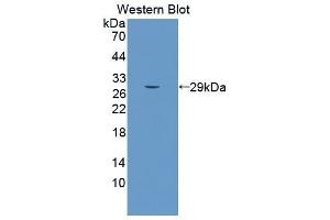 Western Blotting (WB) image for anti-Sema Domain, Seven Thrombospondin Repeats (Type 1 and Type 1-Like), Transmembrane Domain (TM) and Short Cytoplasmic Domain, (Semaphorin) 5B (SEMA5B) (AA 350-602) antibody (ABIN5662014) (SEMA5B anticorps  (AA 350-602))