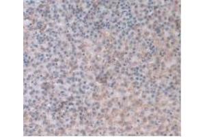 Detection of a1AGP in Rat Adrenal Gland Tissue using Monoclonal Antibody to Alpha-1-Acid Glycoprotein (a1AGP)