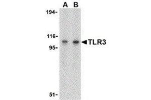 Western Blotting (WB) image for anti-Toll-Like Receptor 3 (TLR3) (C-Term) antibody (ABIN2479740)