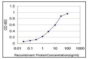 ELISA image for anti-serine/threonine Kinase 17a (STK17A) (AA 301-414) antibody (ABIN614691)