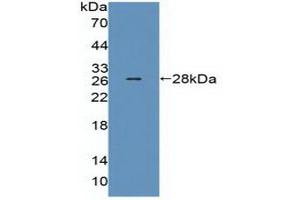Detection of Recombinant MED1, Human using Polyclonal Antibody to Mediator Complex Subunit 1 (MED1) (MED1 anticorps  (AA 1-212))
