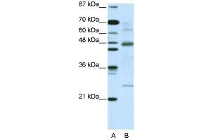 WB Suggested Anti-NFKBIB  Antibody Titration: 5. (NFKBIB anticorps  (C-Term))