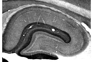 Adult rat hippocampus immunohistochemistry. (ADAM22 anticorps  (Cytosolic))