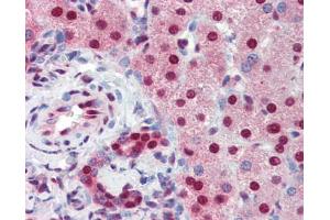 nti-SSB Antibody IHC staining of human liver.