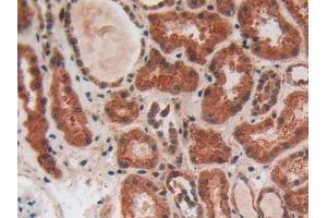 Detection of PLAP in Human Kidney Tissue using Polyclonal Antibody to Phospholipase A2 Activating Protein (PLAP)