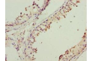 Immunohistochemistry of paraffin-embedded human testis tissue using ABIN7142411 at dilution of 1:100 (MRPL41 anticorps  (AA 14-137))