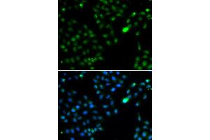 Immunofluorescence analysis of HeLa cell using FKBP3 antibody. (FKBP3 anticorps)