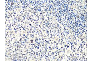 Immunohistochemistry of paraffin-embedded human tonsil using MTA2 Antibody (ABIN5998268) at dilution of 1/100 (40x lens). (MTA2 anticorps)