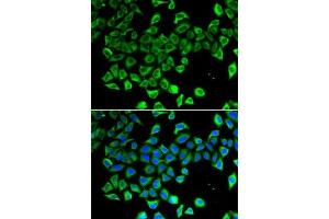 Immunofluorescence analysis of A-549 cells using Lipocalin-2/NGAL antibody (ABIN6128177, ABIN6143114, ABIN6143115 and ABIN6215076). (Lipocalin 2 anticorps)