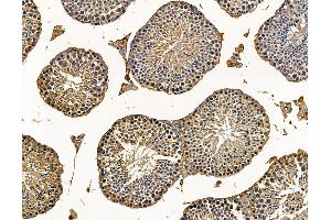 ABIN7095739 and ABIN7099801 at 1/100 staining mouse testis tissue by IHC-P. (MGAT5 anticorps)