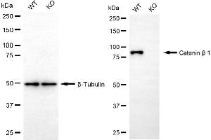 Western blotting analysis using catenin beta 1 antibody (ABIN7797929).