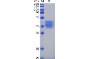 Human CLDN6 Protein, mFc Tag on SDS-PAGE under reducing condition. (Claudin 6 Protein (CLDN6) (mFc Tag))