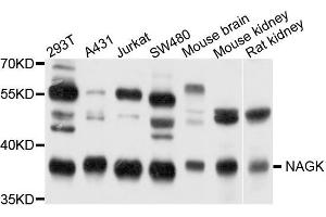 Western blot analysis of extract of various cells, using NAGK antibody. (NAGK anticorps)
