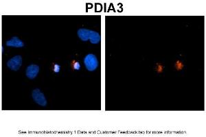 Sample Type: NT2 cells Red: Antibody Blue: DAPI Primary Dilution: 1ug/50ul antibody Secondary Antibody: Alexa goat anti-rabbit 594 Image Submitted by: Yuzhi Chen, University of Arkansas for Medical Sciences (PDIA3 anticorps  (C-Term))